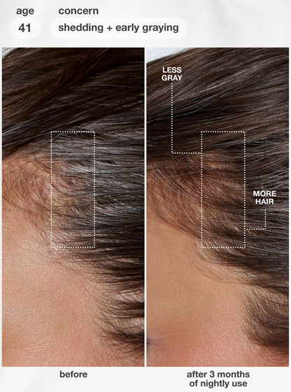 K18 - FutureIQ™ Hair Longevity Serum