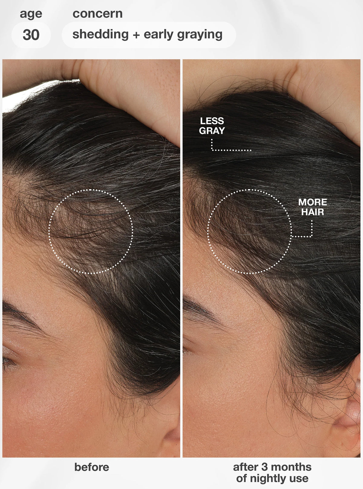 K18 - FutureIQ™ Hair Longevity Serum